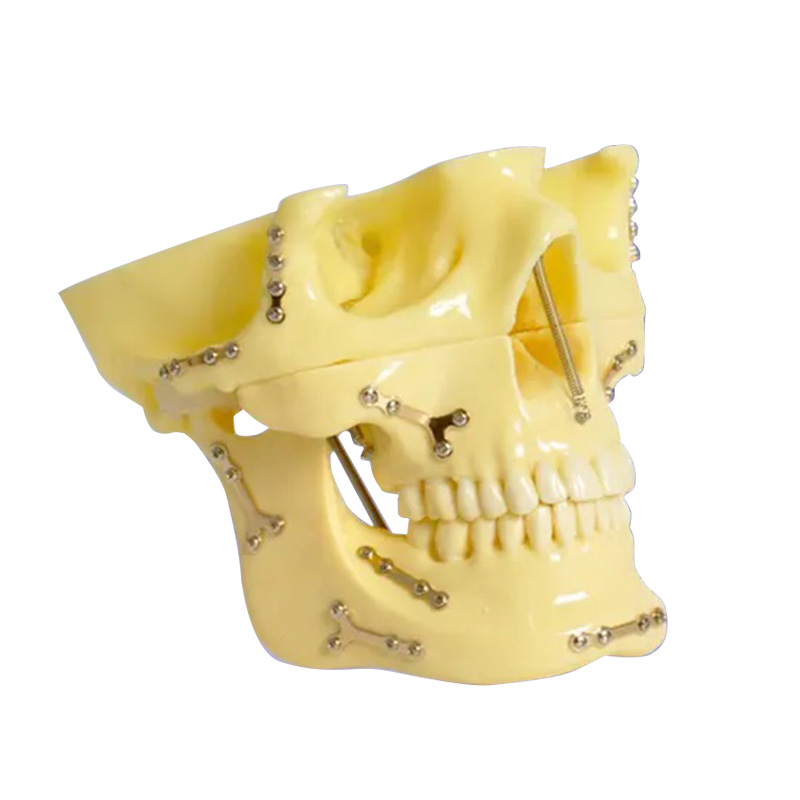 UM-5004 Skull Model